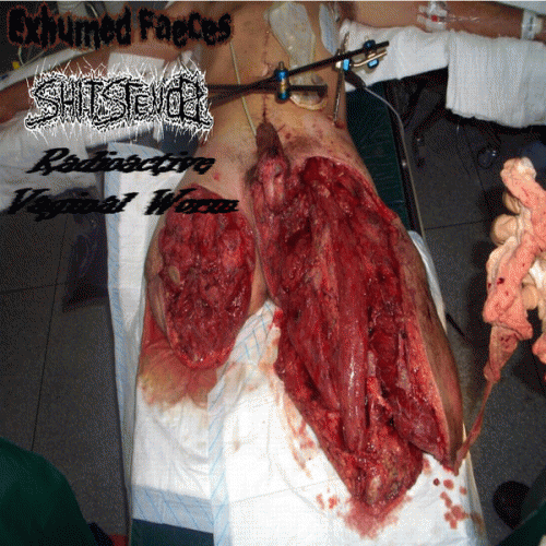 Shitstench : Exhumed Faeces - ShitStench - Radioactive Vaginal Worm